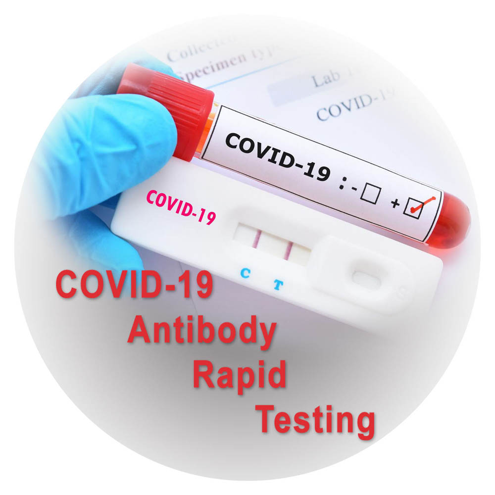 COVID-19 test